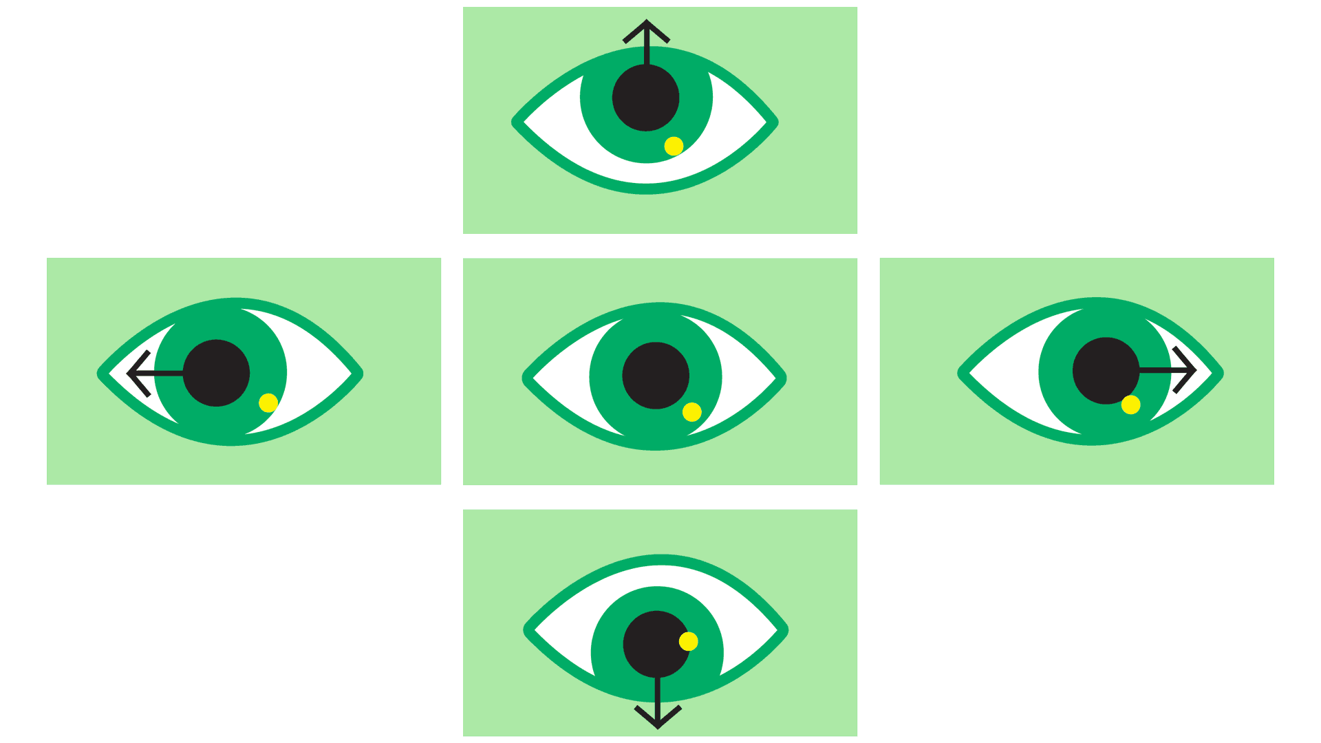 Eyetracking: Reflexionen auf der Iris bei unterschiedlichen Blickrichtungen